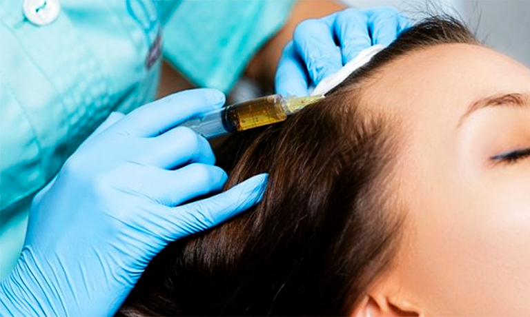 Плазмотерапия – Процедура  лечение выпадения волос